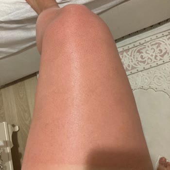 Nivea Güneş Kreminin Hiçbir İşe Yaramaması