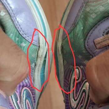 Skechers Işıklı Ayakkabı Garanti Problemi
