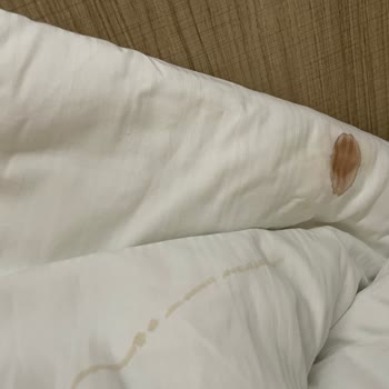 Orka Lotus Beach Hotel Bizim İçin Çok Büyük Bir Hayal Kırıklığı Oldu!