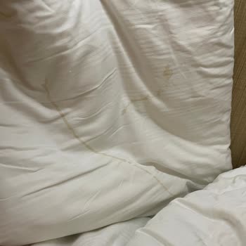 Orka Lotus Beach Hotel Bizim İçin Çok Büyük Bir Hayal Kırıklığı Oldu!