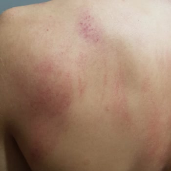 Emniyet Genel Müdürlüğü Polis Vahşeti Kağıthane