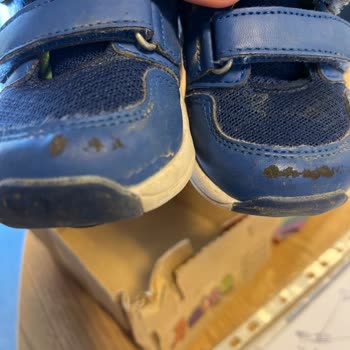 Vicco 3 Ayda Derisi Soyulan Ayakkabı