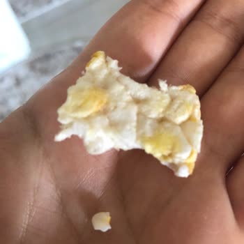 Eti Gıda Eti Gong Eskisi Gibi Değil Dişimi Kırdı