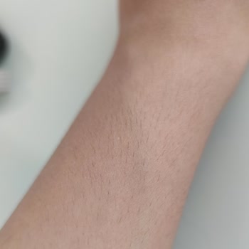 Merve Candan Estetik & Güzellik İşe Yaramıyor