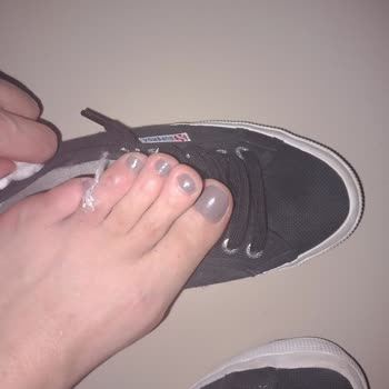 Superga Sorunu Yara İçin De Hir Ayakkabı