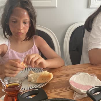 Nurgaz Kamp Tüpü Patlaması