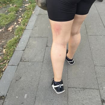 Defans Sinek Kovucunun Hiçbir İşe Yaramaması!