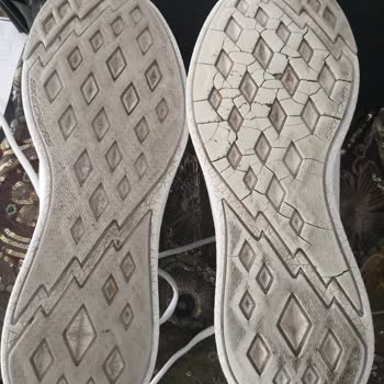 Skechers 'da Tehlikeli Ürün Bozukluğu