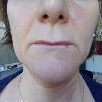 Vital Med Sağlık Ticaret Firması Ve Solgar Marka Tehlikesi