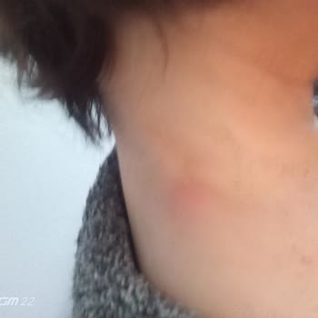 Vital Med Sağlık Ticaret Firması Ve Solgar Marka Tehlikesi