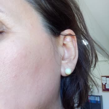 Vital Med Sağlık Ticaret Firması Ve Solgar Marka Tehlikesi