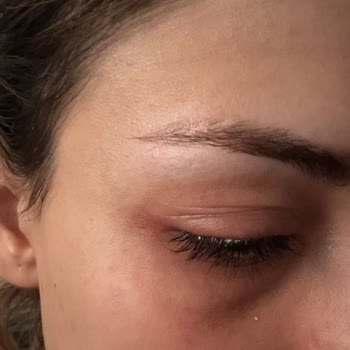 You Estetik İşletme Sahibi Tarafından Mağduriyet