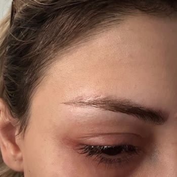 You Estetik İşletme Sahibi Tarafından Mağduriyet