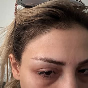 You Estetik İşletme Sahibi Tarafından Mağduriyet