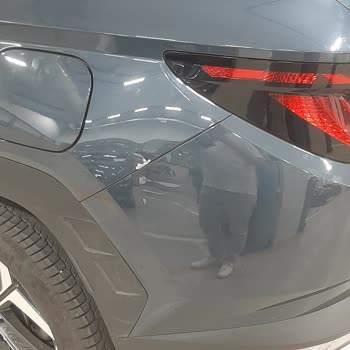 Hyundai Yetkili Servisinde Aracıma Zarar Verilmesi
