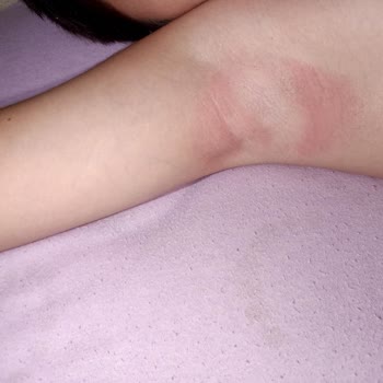 Fenerium Çocuk Forması Çok Kalitesiz Ve Çocuğumda Pişik Yaptı