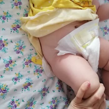 Prima Premium Care Bebek Bezi Bel Bantları Kopuyor