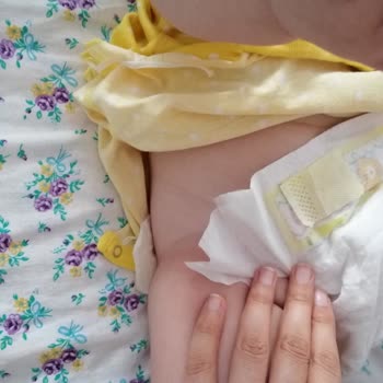 Prima Premium Care Bebek Bezi Bel Bantları Kopuyor