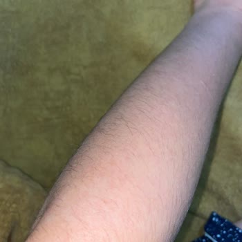 Dilan Polat Estetik Lazer Epilasyon Ve Randevu