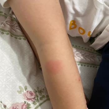 Raid Electro Likit Makine Hiçbir İşe Yaramıyor