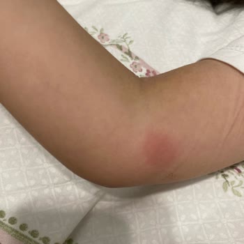 Raid Electro Likit Makine Hiçbir İşe Yaramıyor