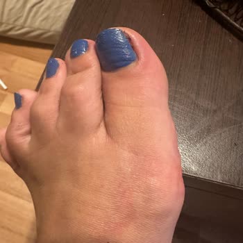 Smc Kuaför Ve Güzellik Salonu Pedikür Hizmetinden Mikrop Kaptım