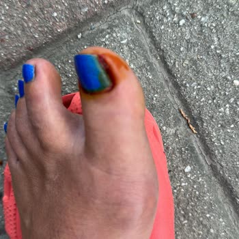 Smc Kuaför Ve Güzellik Salonu Pedikür Hizmetinden Mikrop Kaptım