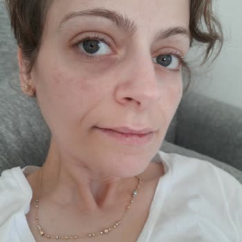 Trendyol Farma Hanem Orijinalliği Şüpheli Ürün Satıyor