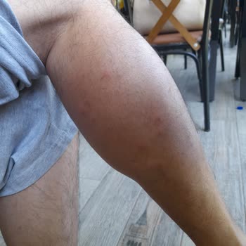 Hello Villam Hello Villa _ Serik Antalya Şikayet