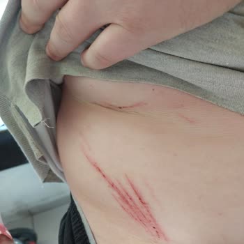 Crystal Hotels Kemer Prestige Elit Duşa Kabin Camı Kırıldı