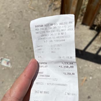 Dentvan Ağız Ve Diş Sağlığı Polikliniği Diş Temizleme İşlemi