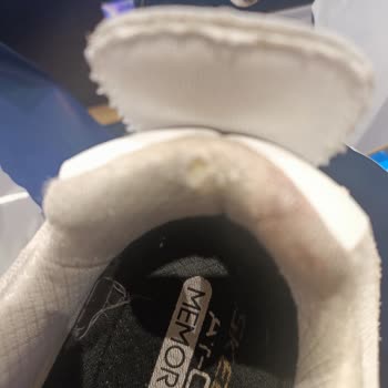 Skechers Ayakkabısında Yaşanan Sorun