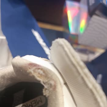 Skechers Ayakkabısında Yaşanan Sorun