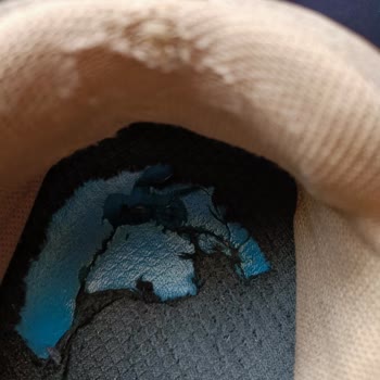 Skechers Ayakkabısında Yaşanan Sorun