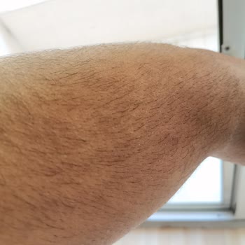 Gentleman Saloon Epilasyon Ve Peeling