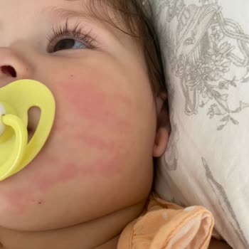 Sleepy Ecologic Bebek Havlusu Bebeğimin Yüzünü İnanılmaz Kızarttı