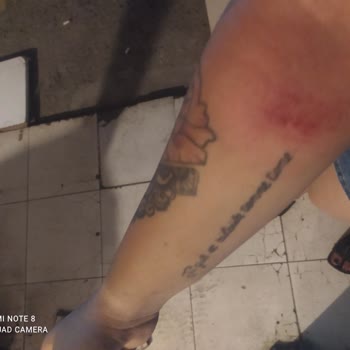 İzmir Büyükşehir Belediyesi Zabıtanın Kolumu Çizmesi İtelemesi