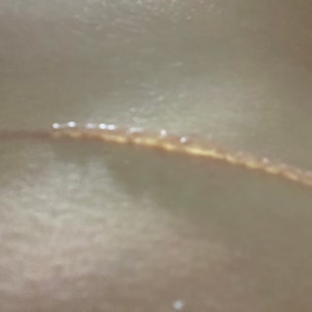 Penti Silikon Sütyen Yanık