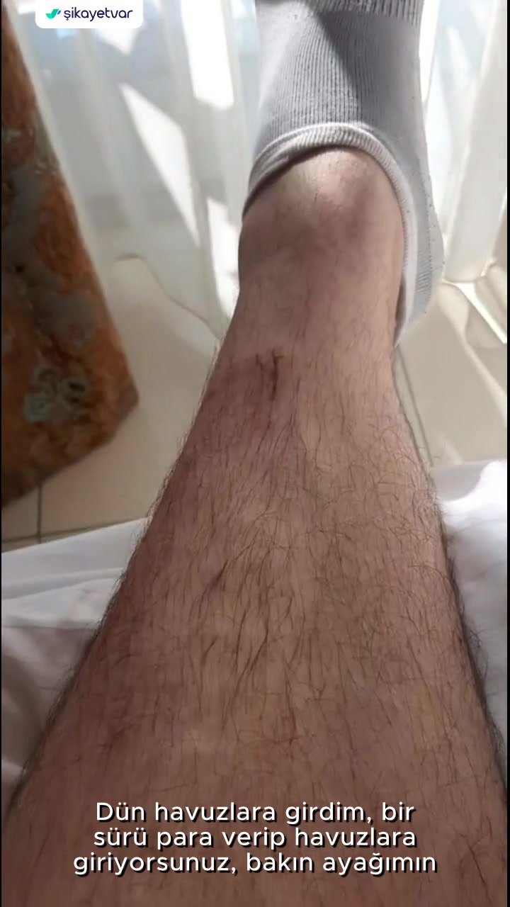 Özgül Termal Havuz Emniyetsizliği videonun kapak resmi