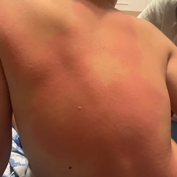 BİM'den Alınan Bozuk Limonata