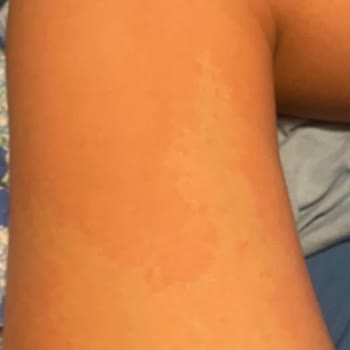 BİM'den Alınan Bozuk Limonata