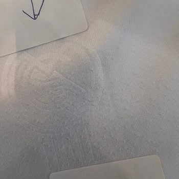 Adidas Formanın Hayal Kırıklığı