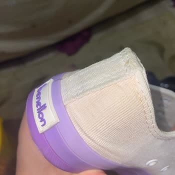 Benetton Marka Converse Temizledikten Sonra Turunculaştı