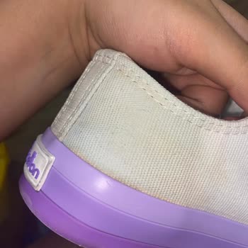 Benetton Marka Converse Temizledikten Sonra Turunculaştı
