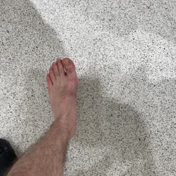 Birkenstock Terlik Ayağımı Yara Yaptı!