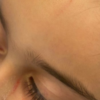 Ayme Karadeniz Lokantası İşletme Torunumun Yüzünü Parçaladı, Özür Bile Dilemedi!