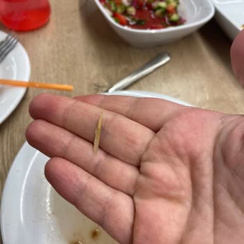 Köfteci Yusuf Yemeğimin İçinden Kırılmış Kürdan Çıktı ve Boğazıma Saplandı!