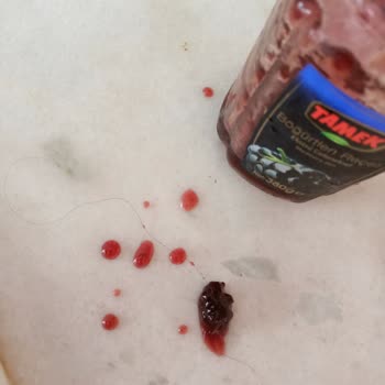 Tamek Reçelden Saç Çıktı!