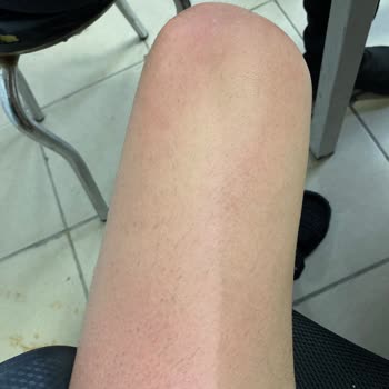 Mustela Güneş Kremi Korumaması