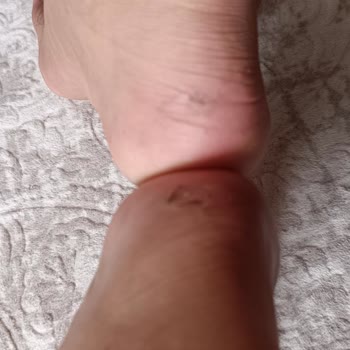 FLO Ayakkabı İmalat Hatası Ürün İadesi (değişim) Kabul Etmemeleri